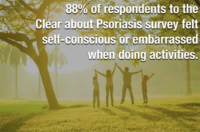 Struggling with Psoriasis? 4 Areas of Life You Can Manage for Better Wellbeing
