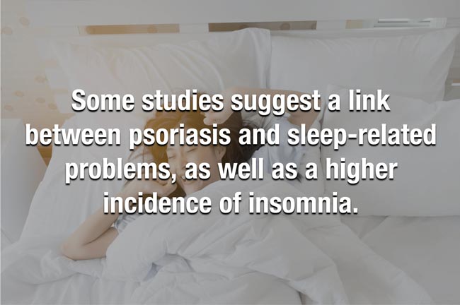 Struggling with Psoriasis? 4 Areas of Life You Can Manage for Better Wellbeing